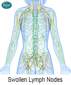 LymphoCare Swollen Lymph Nodes Depiction